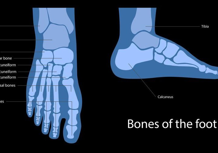 Pronacja stopy: co to jest i jak ją korygować