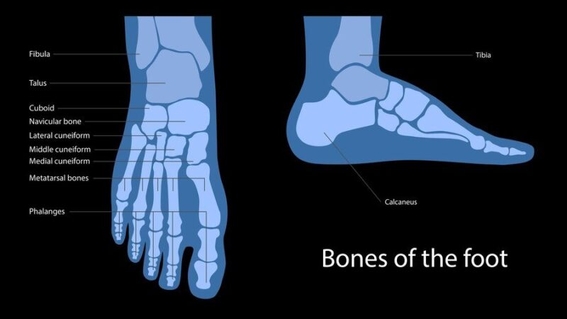 Pronacja stopy: co to jest i jak ją korygować