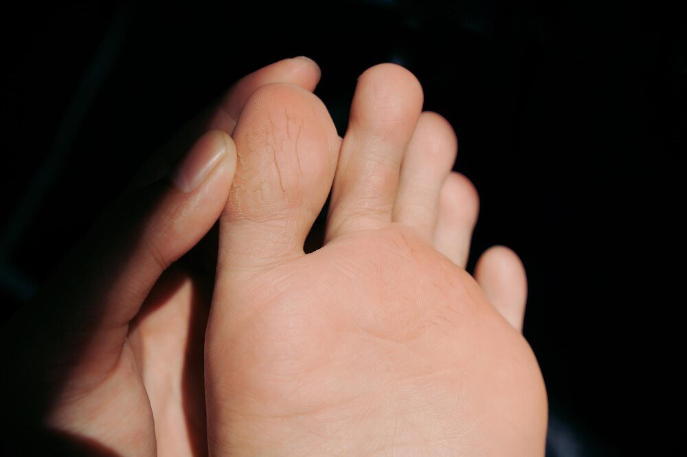 Jak zapobiegać i leczyć odciski na dłoniach podczas treningu siłowego